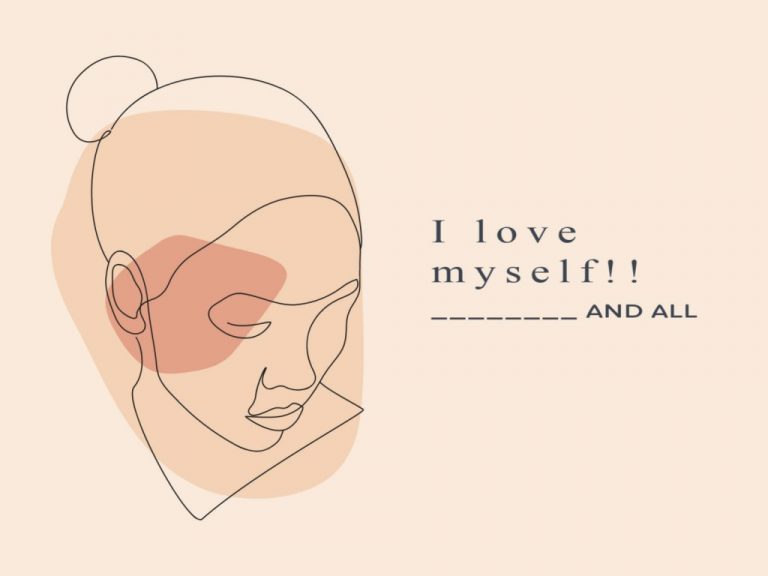 Embracing My Melasma